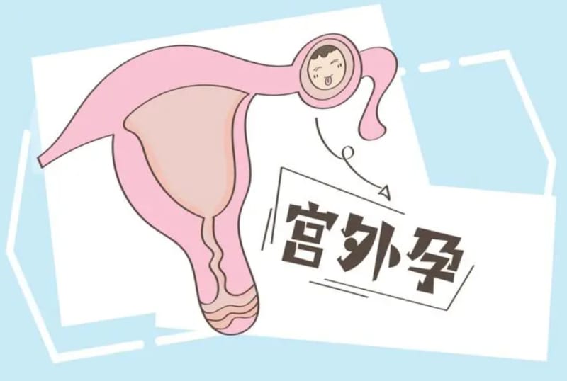 试管婴儿怎样避免宫外孕，试管婴儿避免宫外孕方法(图1)
