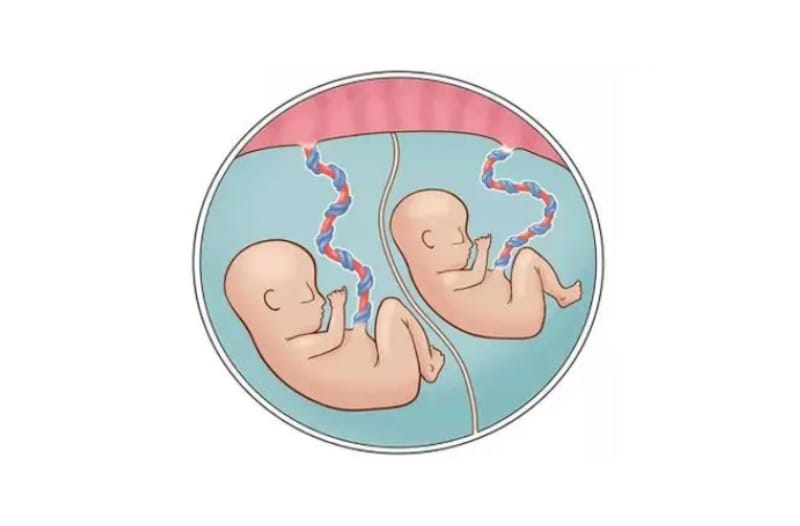 成都试管婴儿可以选择双胞胎吗？(图1)