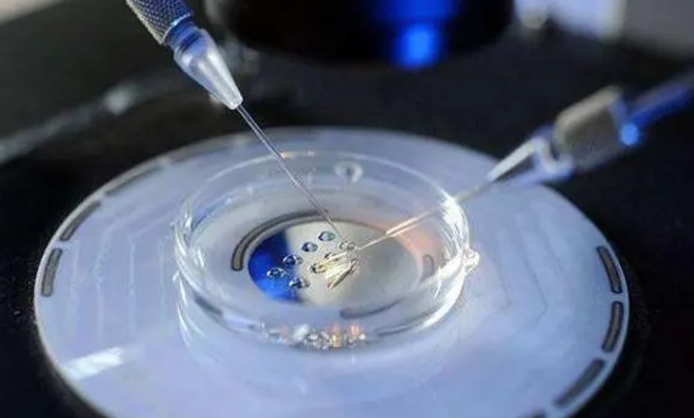 怎么选择冻胚移植子宫内膜的准备方案？