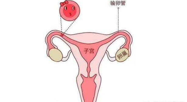输卵管结核治愈后能自然怀孕吗？能不能做试管？