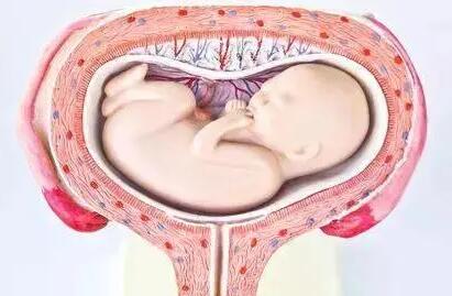 单角子宫合并残角子宫做试管可以移植几个胚胎？