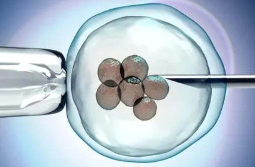 残角子宫试管能怀双胞胎吗费用多少钱？