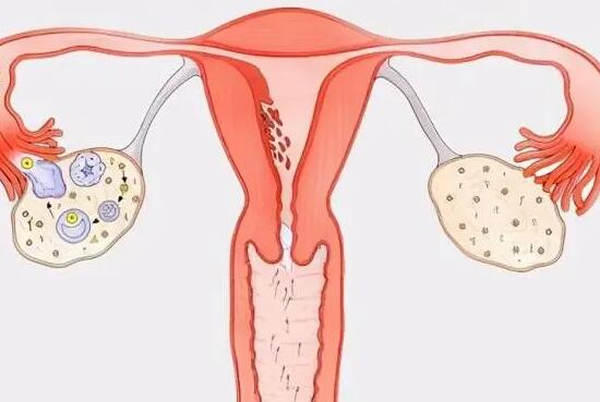 宫腔粘连术后移植冻胚成功率高吗？(图1)