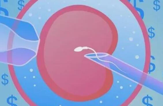 多囊卵巢做试管婴儿用什么方案好一点多少钱？(图1)