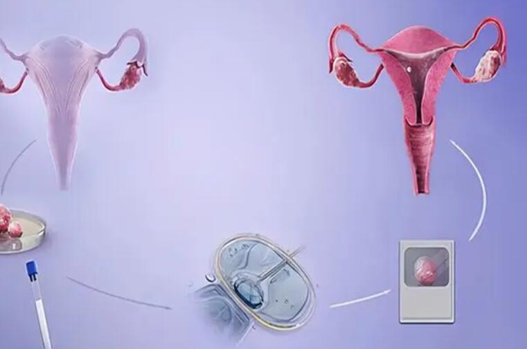 多囊卵巢做试管是不是更有优势？成功率高吗？(图1)