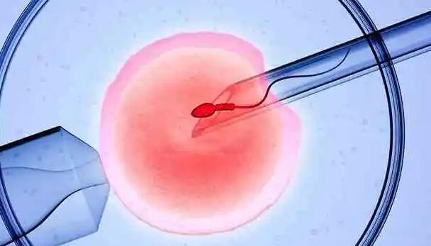 多囊卵巢做试管婴儿用什么方案好一点？(图1)