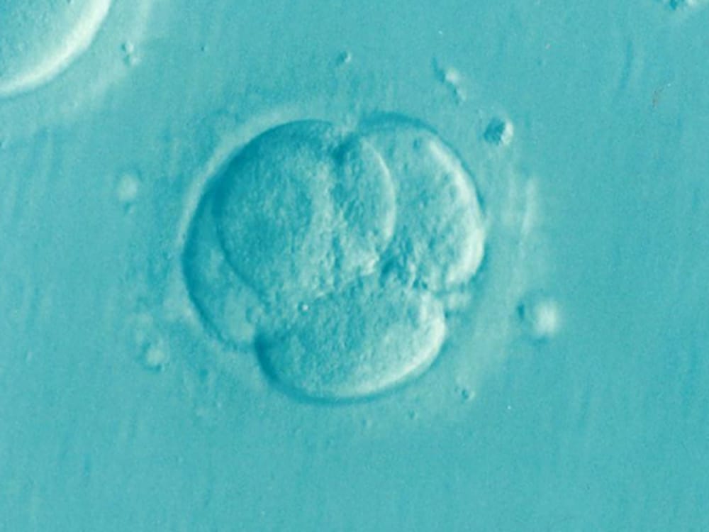 试管取卵后第三天的胚胎级别10.9.8是怎么区分的？