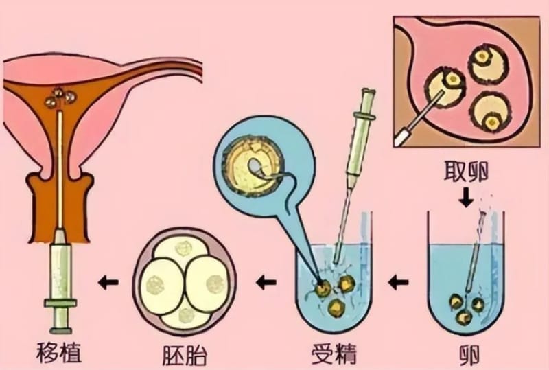 武汉供卵试管婴儿哪里可以做，供卵试管婴儿合法吗(图1)