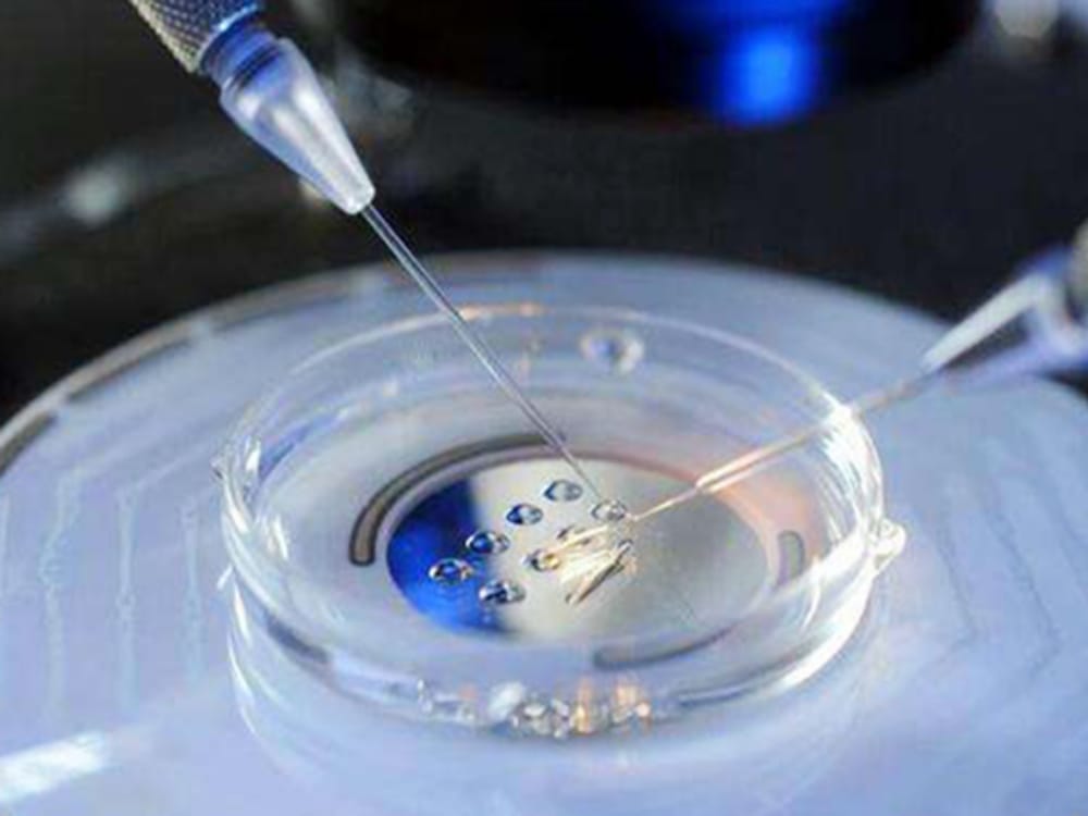 梅州人民医院试管婴儿花费明细，促排取卵单周期3万起
